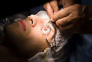 Lasik Surgery Cost in Delhi