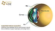 What If My Cornea Is Too Thin for LASIK?