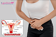 Endometriosis: A Complex and Painful Condition