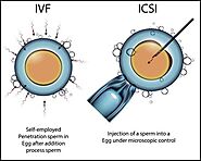 Intracytoplasmic Sperm Injection (ICSI) in In Vitro Fertilization (IVF): A Comprehensive Guide