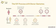 IVF with Donor Egg and Sperm: A Hopeful Path to Parenthood