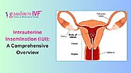 Intrauterine Insemination (IUI): A Comprehensive Overview