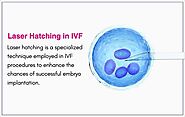 Laser hatching in IVF