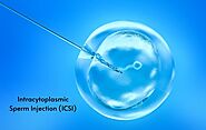 ICSI Procedure Step by Step | ICSI Success Rate | Gaudium IVF