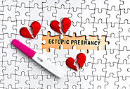 How to Avoid Ectopic Pregnancy with IVF