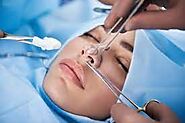 Unveiling the Secrets: Rhinoplasty Trends in Dubai You Need to Know