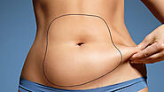 Dubai's Secret to Body Perfection: Liposuction Unveiled