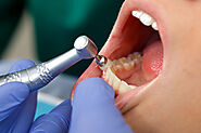 How is Periodontal Disease Treated?: ext_6636978 — LiveJournal