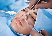 Transform Your Life: Rhinoplasty for Sinus Relief and Confidence