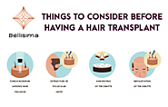Things to Consider Before Having a Hair Transplant