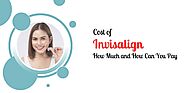 Cost of Invisalign: How Much and How Can You Pay