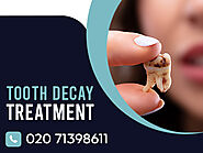 Tooth Decay Causes & Treatments - Smile Clinic London