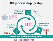 Best IUI Treatment in Hyderabad