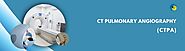 Is Pulmonary Embolism Dangerous? Early Detection with CT