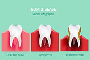 Gum Disease