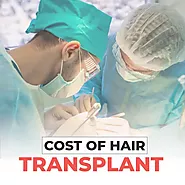 Hair Transplant Cost in Karachi - Hair Transplant in Karachi Price