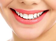 Teeth Whitening - Smile Design Treatment | Sainikpuri