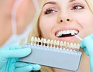 Dental Veneers Clinic in Sainikpuri, HYD | Get Perfect Smile