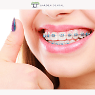 Transform Your Smile with Confidence in Bukit Timah | Garden Dental Braces