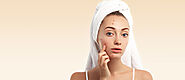 Is Your Acne Itchy? Here’s What It Means– And How To Deal