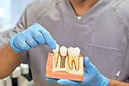 Why Dental Implants Are a Permanent Solution for Missing Teeth