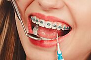 Top Foods to Enjoy and Avoid with Braces