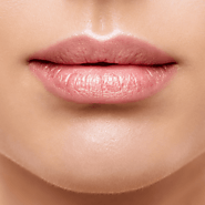 Lip Injections Vancouver | Lip Fillers Yaletown | Yaletown Laser Centre