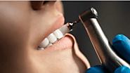 How to Make Your Dental Cleaning Last Longer?