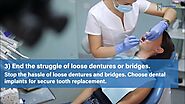 Why You Should Think About Getting a Dental Implant