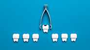 Different Types of Tooth Extraction