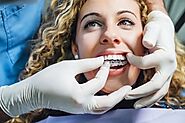 Straighten Your Teeth Discreetly with Invisalign Services in Miami