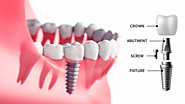 Dentist Croydon Park