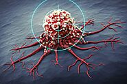 Understanding Targeted Therapy: A Breakthrough in Cancer Treatment | Oncare Cancer