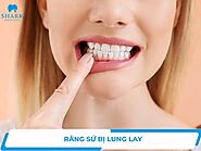 Răng sứ bị lung lay