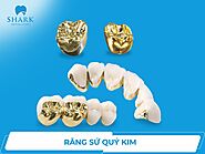 Răng sứ quý kim có tốt không