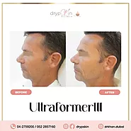 Best HIFU Treatment in Dubai | Drypskin