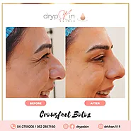 Rediscover Youthful Beauty with Botox in Dubai | DrypSkin