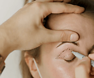 Eyelid Rejuvenation Experts | Rediscover Your Natural Beauty