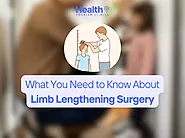 What You Need to Know About Limb Lengthening Surgery - 2023