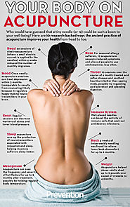 The Ultimate Guide To Eliminate Back Pain With Acupuncture Therapy