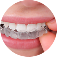 Invisalign System | Invisalign Braces | Invisalign Orthodontist in Spring