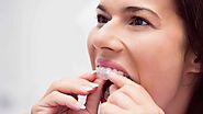 Why Invisalign Could Be the Ideal Solution for Your Dental Alignment