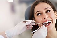 Maximizing the Lifespan of Dental Fillings: Expert Advice