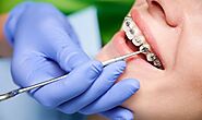 Orthodontist in Tulsa: Your Partner for a Straighter Smile