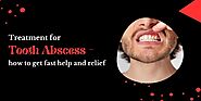 Treatment for tooth abscess – how to get fast help and relief - Fox News Today