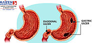 Managing Stomach Ulcers in the Duodenum: Effective Treatment Strategies