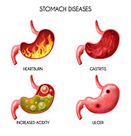 What are the gastric problems?