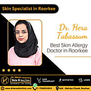 Skin Allergy Doctor In Roorkee | Best Doctor for Skin Allergy Treatment