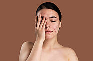 Acne Scar Treatment in Roorkee, Acne Scar Removal - Dermatologist in Roorkee