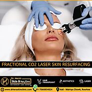 fractional co2 laser Skin Resurfacing - Dermatologist in Roorkee